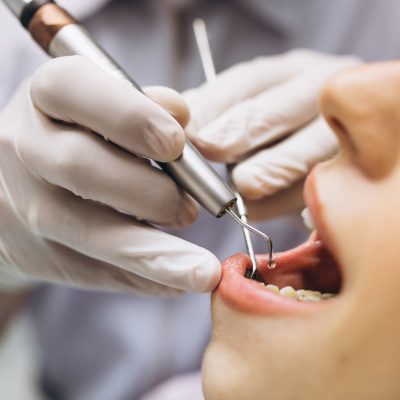 TRF-1 invalida decisão do Conselho Federal de Odontologia que impede cirurgia plástica no nariz.